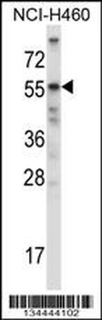 Mouse Acvr2b Antibody (Center)