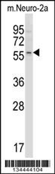 Mouse Acvr2b Antibody (Center)