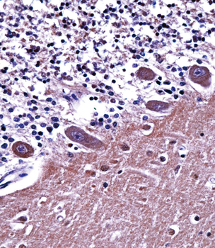 AP2A1 Antibody (C-term)
