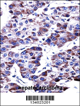 DUSP9 Antibody (C-term)