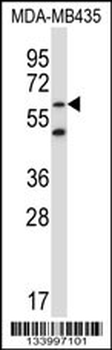 ZNF479 Antibody (N-term)