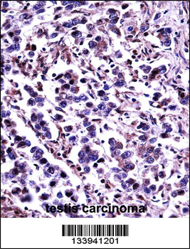 CAPN11 Antibody (Center)
