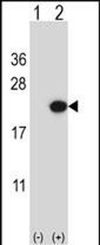 EDN2 Antibody (C-term)