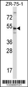 TERF2 Antibody (Center)