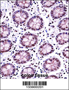TERF2 Antibody (Center)