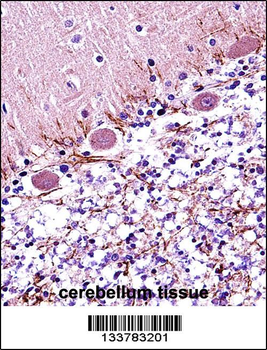 RARA Antibody (C-term)