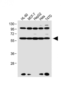 RARA Antibody (C-term)