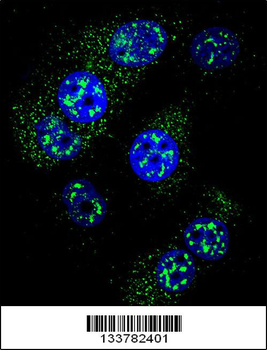 MGMT Antibody (N-term)