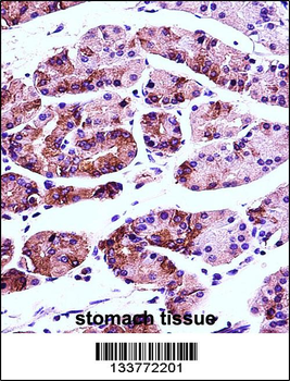 AGR2 Antibody (N-term)