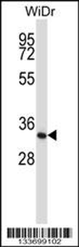 XPA Antibody (C-term)
