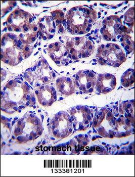 SLC41A2 Antibody (N-term)