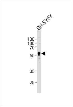 ABHD3 Antibody (C-term)