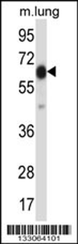 POF1B Antibody (Center)