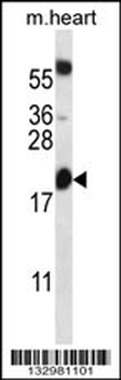 BCL2 Antibody (Center)