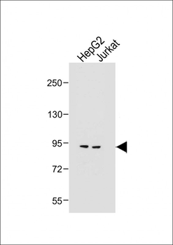 MGAT5 Antibody (C-term)