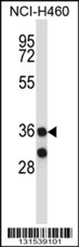 MARCH11 Antibody (C-term)