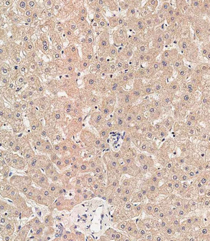 RAB1B Antibody (C-term)