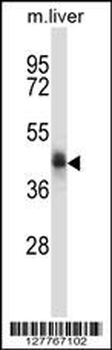C5orf33 Antibody (Center)