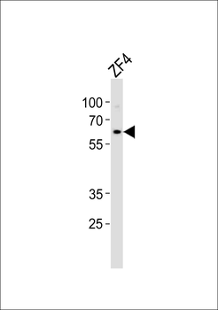 Mouse Camk2d Antibody (Center)