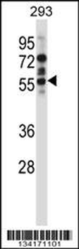 Mouse Camk2d Antibody (Center)