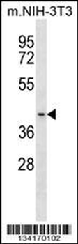 Mouse Bckdk Antibody (Center)