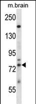 Mouse Adrbk1 Antibody (C-term)
