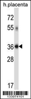 DHRS7C Antibody (Center)