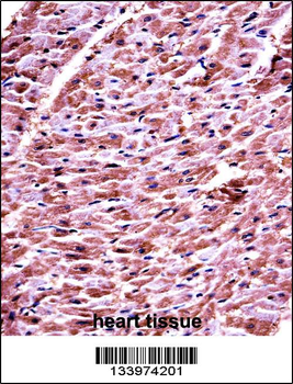 DHRS7C Antibody (Center)