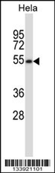 MAVS Antibody (C-term)