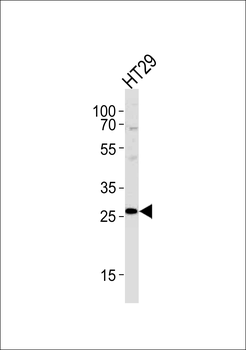 NNMT Antibody (Center)