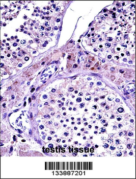 NR0B1 Antibody (Center)
