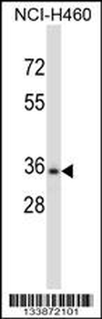 CELA3B Antibody (N-term)