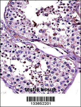 CTAG2 Antibody (Center)
