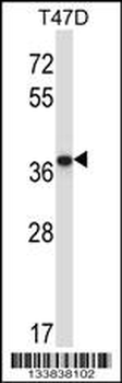 PPP2CB Antibody (C-term)