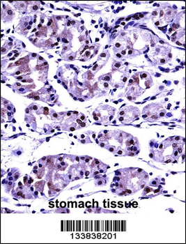 PPP2CB Antibody (C-term)