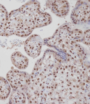 TARDBP Antibody (N-term)
