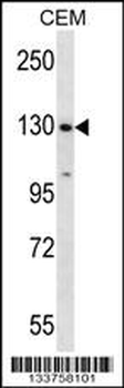 SF3B1 Antibody (N-term)