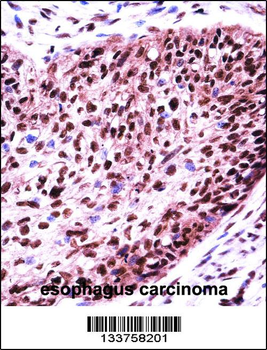 SF3B1 Antibody (N-term)