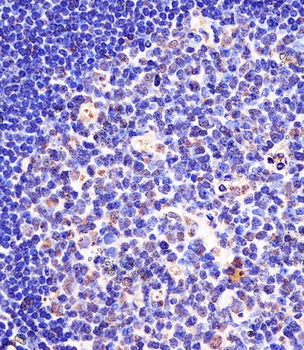 SF3B1 Antibody (N-term)