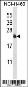 IL13 Antibody (C-term)