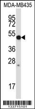 MMP28 Antibody (Center)