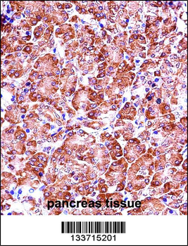 MMP28 Antibody (Center)