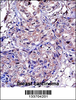 MMP11 Antibody (C-term)