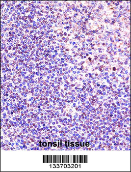 ANP32A Antibody (Center)