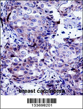 CTTN Antibody (Center)