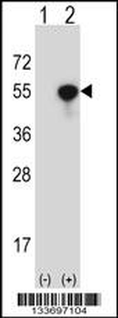NCK1 Antibody (N-term)