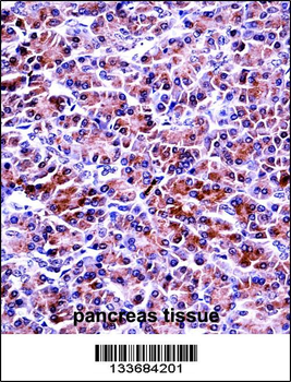 PRSS2 Antibody (Center)