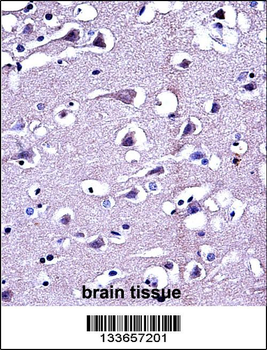 MMP16 Antibody (C-term)