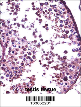 SUMO1 Antibody (N-term)