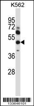 MMP13 Antibody (Center)
